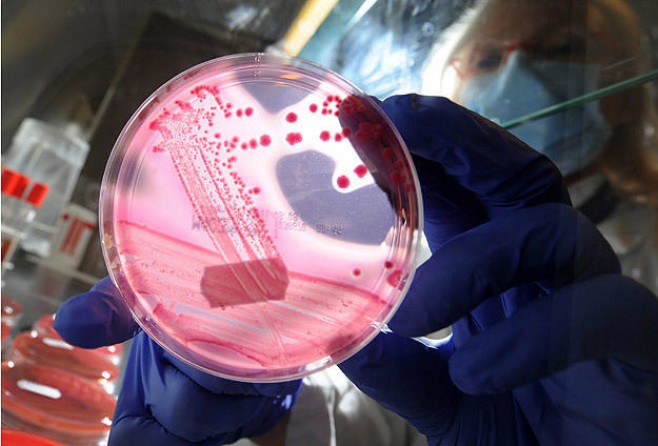 Kanser hücrelerini gösteren gözlük