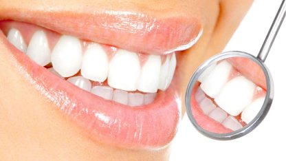 Diş beyazlatmada doğru bilinen yanlışlar!