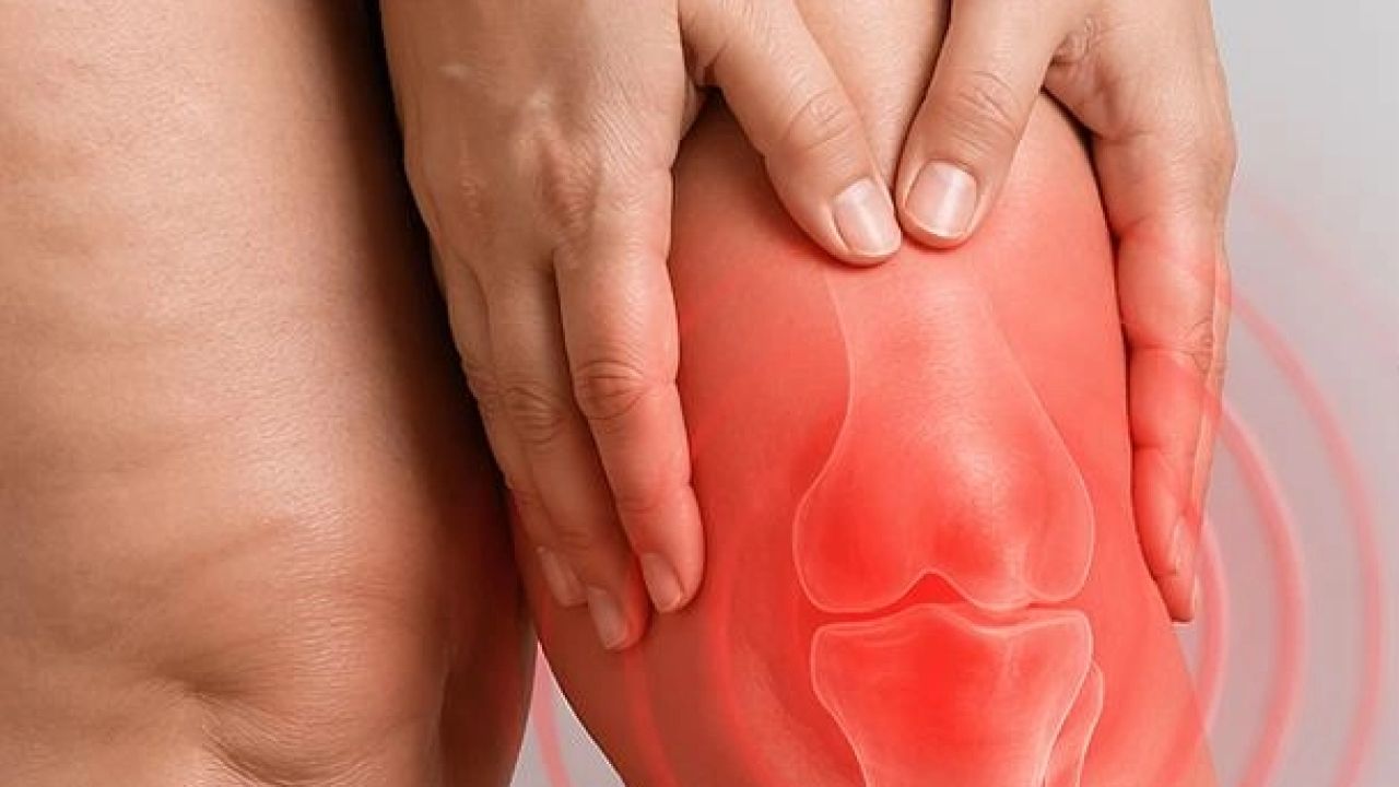 Diz biyomekaniğini bozan süreç: Lipödem